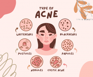 Pink and Brown Illustrated Acne Types Facebook Post 3