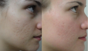 Spa Làm Sạch Lỗ Chân Lông:1 Giải Pháp Hoàn Hảo Cho Làn Da Sạch Sâu Và Khỏe Mạnh 2 screenshot 1724158282