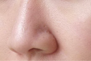 Spa Làm Sạch Lỗ Chân Lông:1 Giải Pháp Hoàn Hảo Cho Làn Da Sạch Sâu Và Khỏe Mạnh 1 screenshot 1725127307